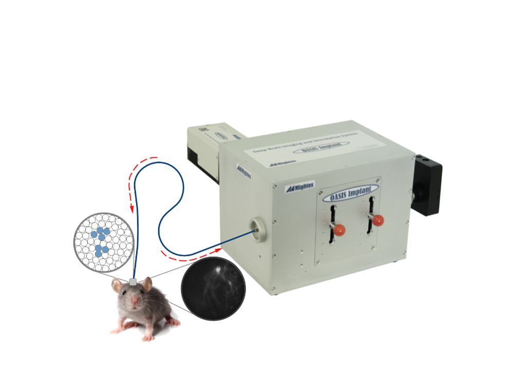 OASIS Implantの画像2